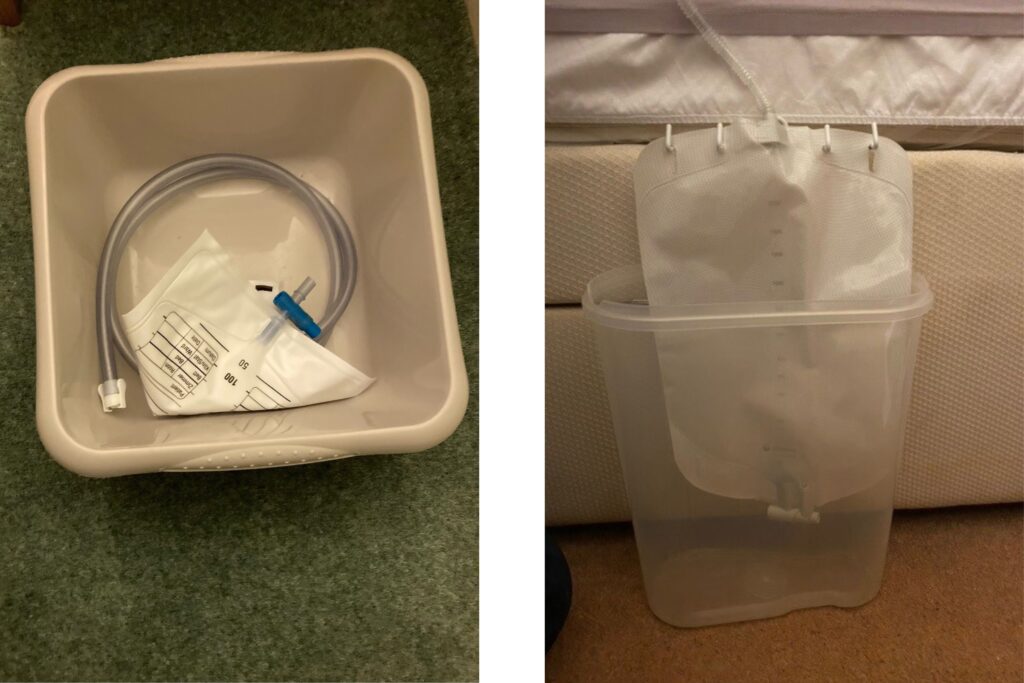 These two photographs were supplied by Urostomy Association supporters, Brian (left) and Alistair (right). They show their night bag arrangements.